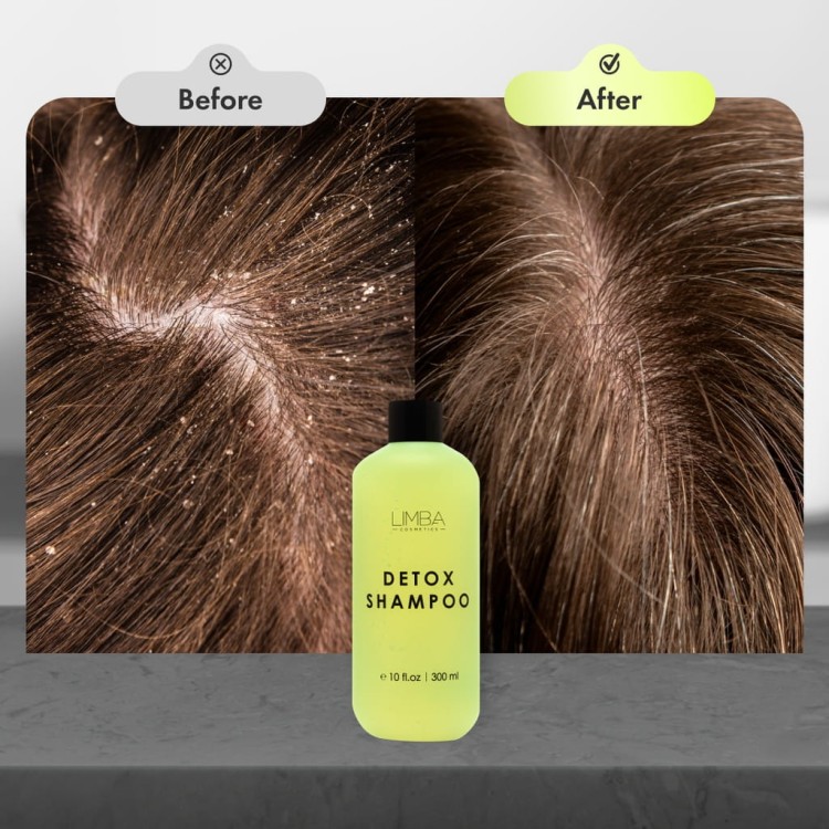 Limba Detox Oily Hair Cleansing Shampoo, szampon oczyszczający do włosów przetłuszczających się, Limba Cosmetics, 300ml